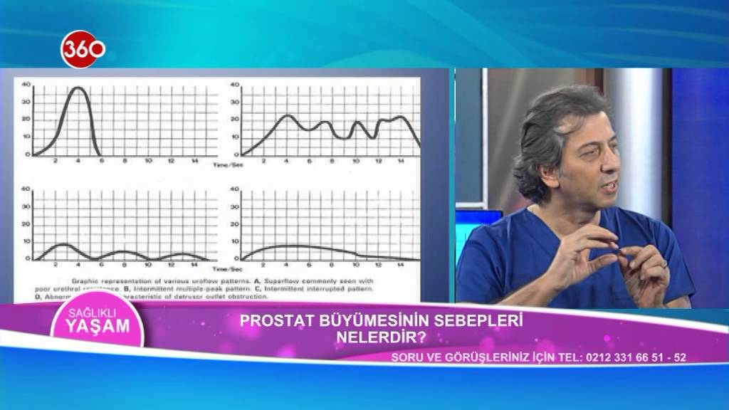 REMZİ SAĞLAM-PROSTAT TEDAVİSİ 09 01 2015