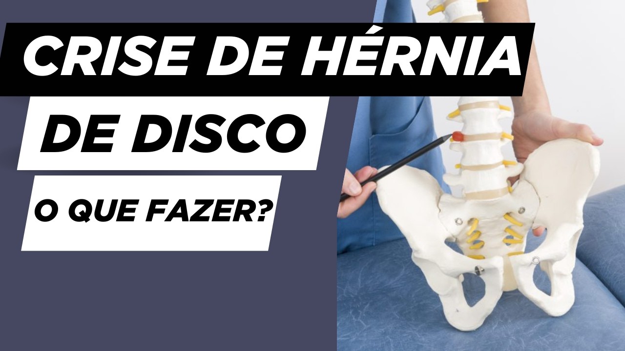 HÉRNIA DE DISCO? O primeiro passo para sair da crise AGUDA!