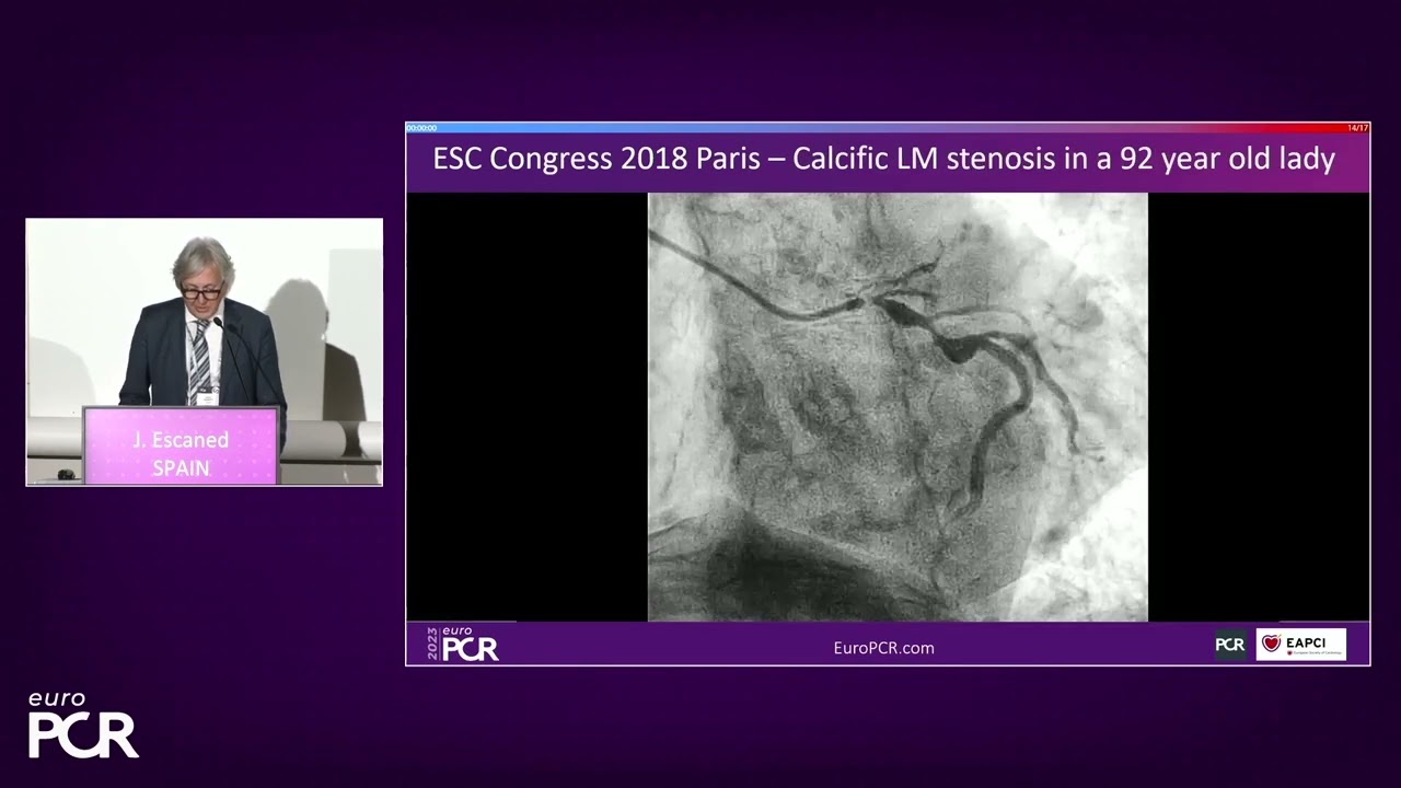 EuroPCR 2023 Symposium: Intravascular Lithotripsy in the Real World: The Revolution Continues