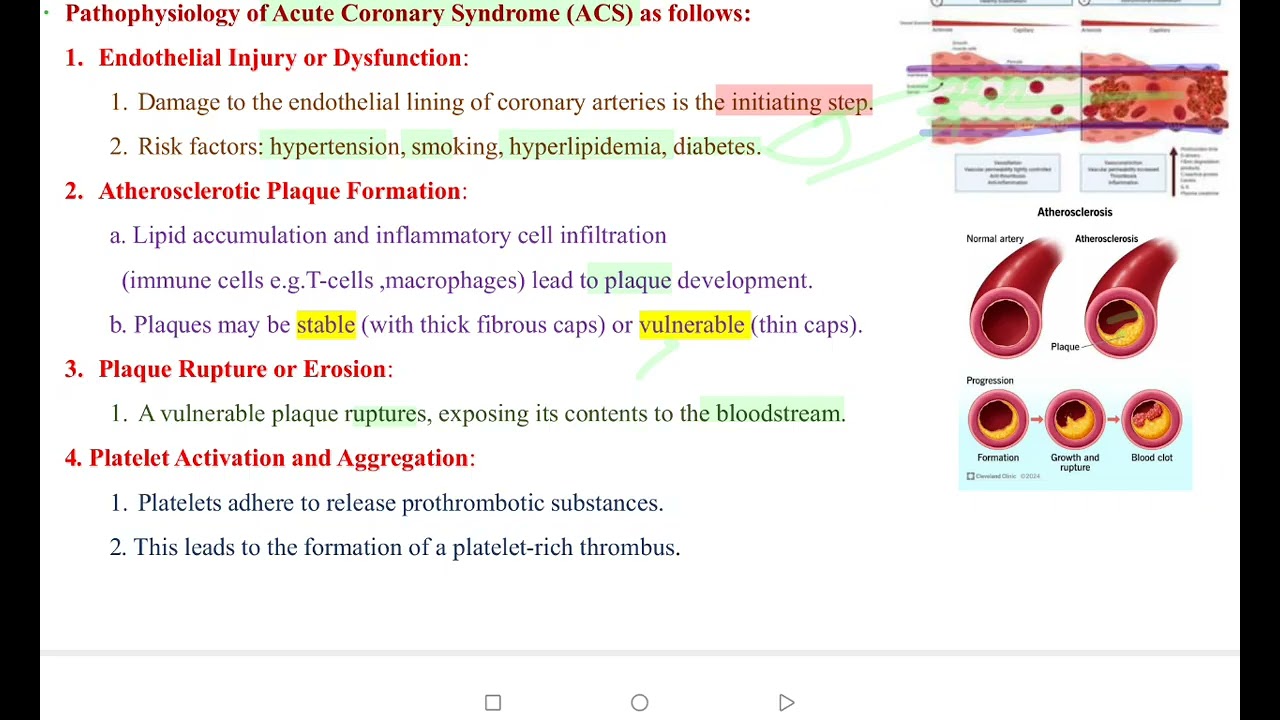 Acute coronary syndrome /Applied /5th/(مادة الكويز) 
