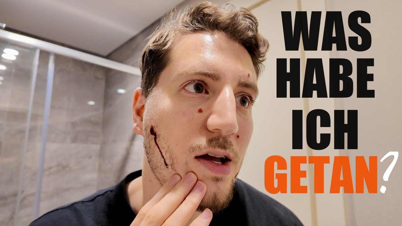 ICH HABE ALLE MEINE MUTTERMALE ENTFERNEN LASSEN! 🤕 Ebru & Tuncay Vlogs