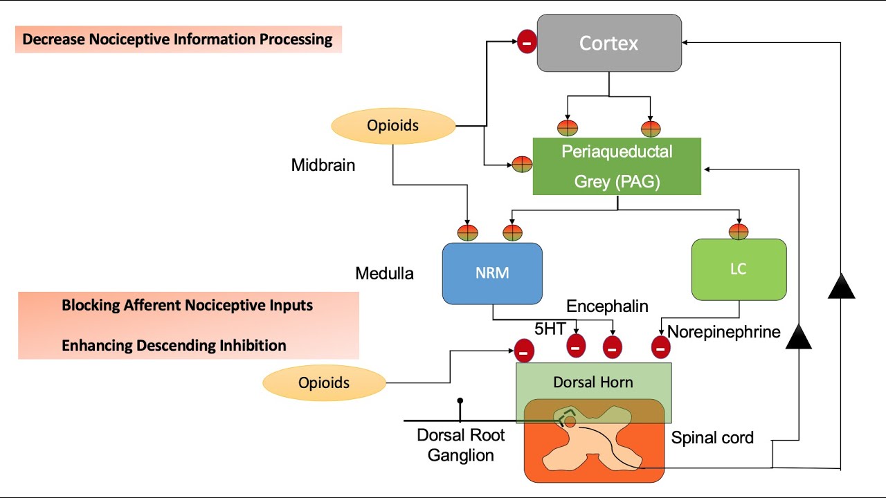 ACUTE PAIN MX: Applying Current Practice Trends in Perioperative Analgesia, Options and Alternatives