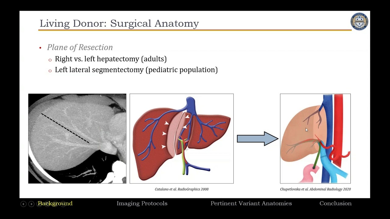48. Imaging Evaluation of Liver Transplantation Part 1. By Prof. Dr. Amir Borhani