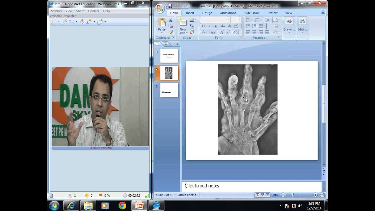Radiology Spotters Part 19 Maffuci Syndrome