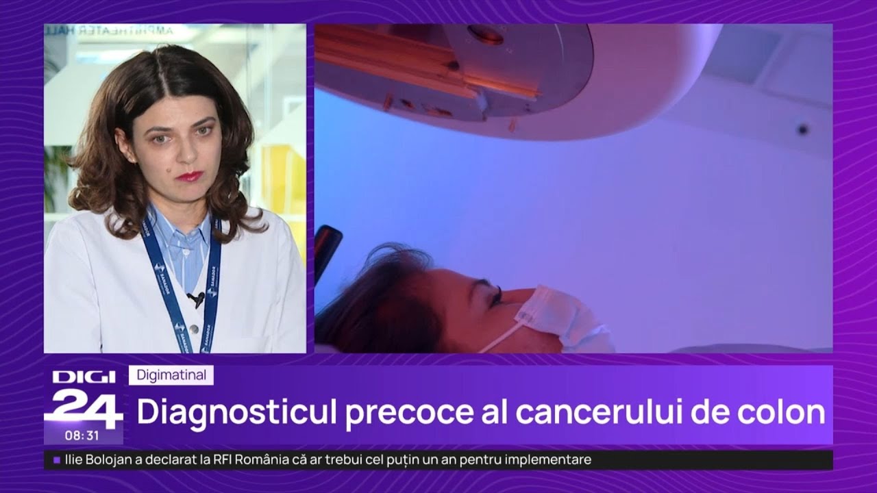 Diagnosticul precoce al cancerului de colon – Dr. Florentina Bratu | Centrul Oncologic SANADOR