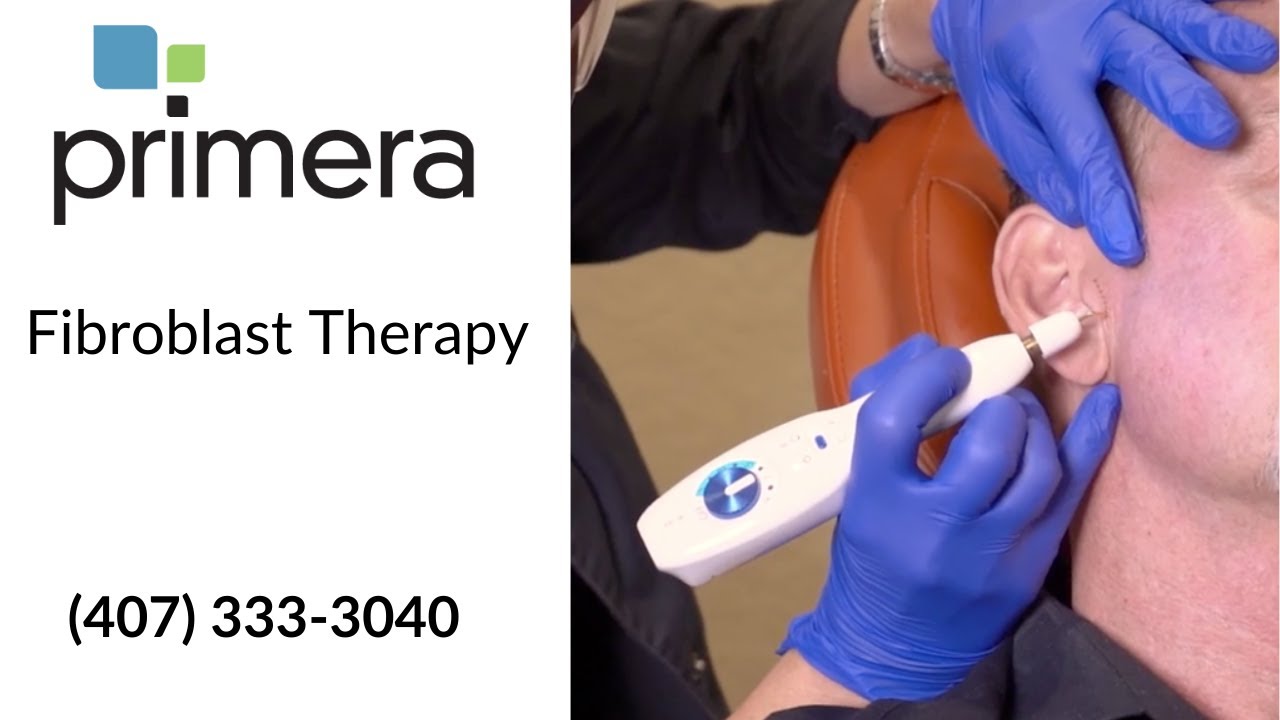 What is Fibroblast treatment?