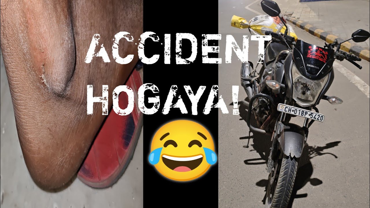 आज का दिन कभी नहीं भूलूँगा! 💔 Accident & Hard Day | पैर पर गाड़ी चढ़ा दी! 😭 RIDERXUP19 Day 14
