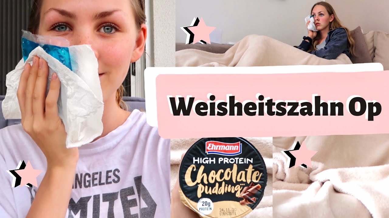 Weisheitszahn Op Vlog / Essen, Ablauf, Schmerzen, Schwellung