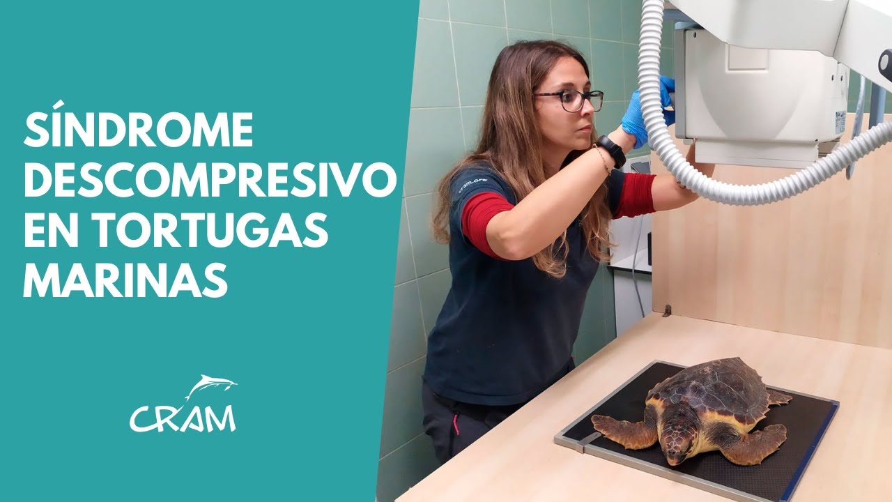 ¿QUÉ ES EL SÍNDROME DESCOMPRESIVO?