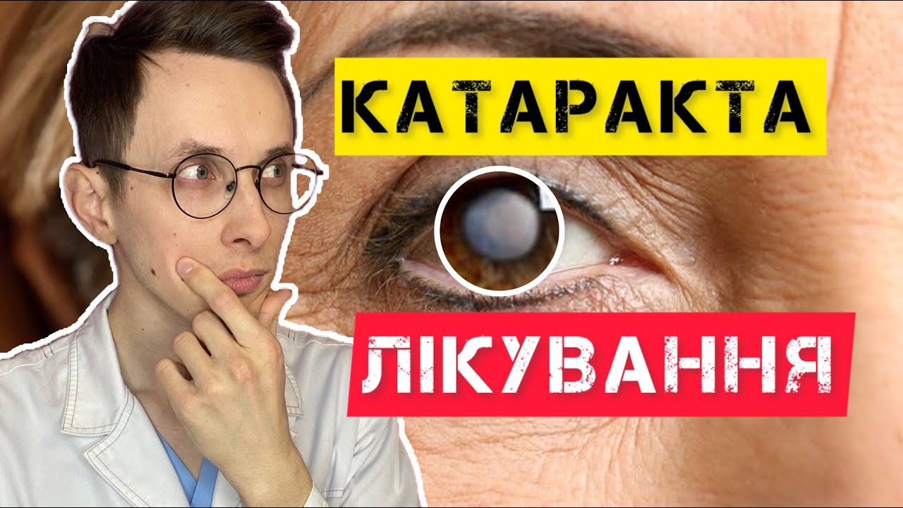 Що таке КАТАРАКТА? І Як ЛІКУВАТИ? І Причини (простими словами)