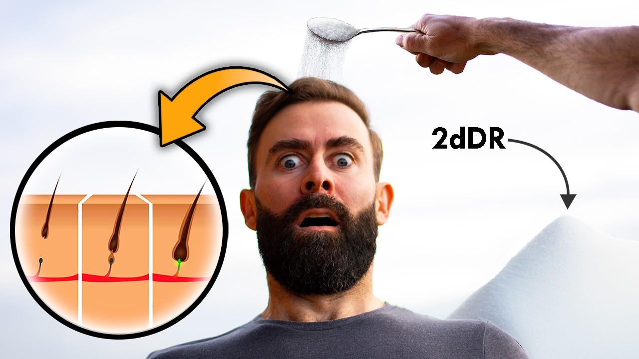 El Azúcar Que Detiene La Alopecia Y Regenera Tu Pelo (2dDR)