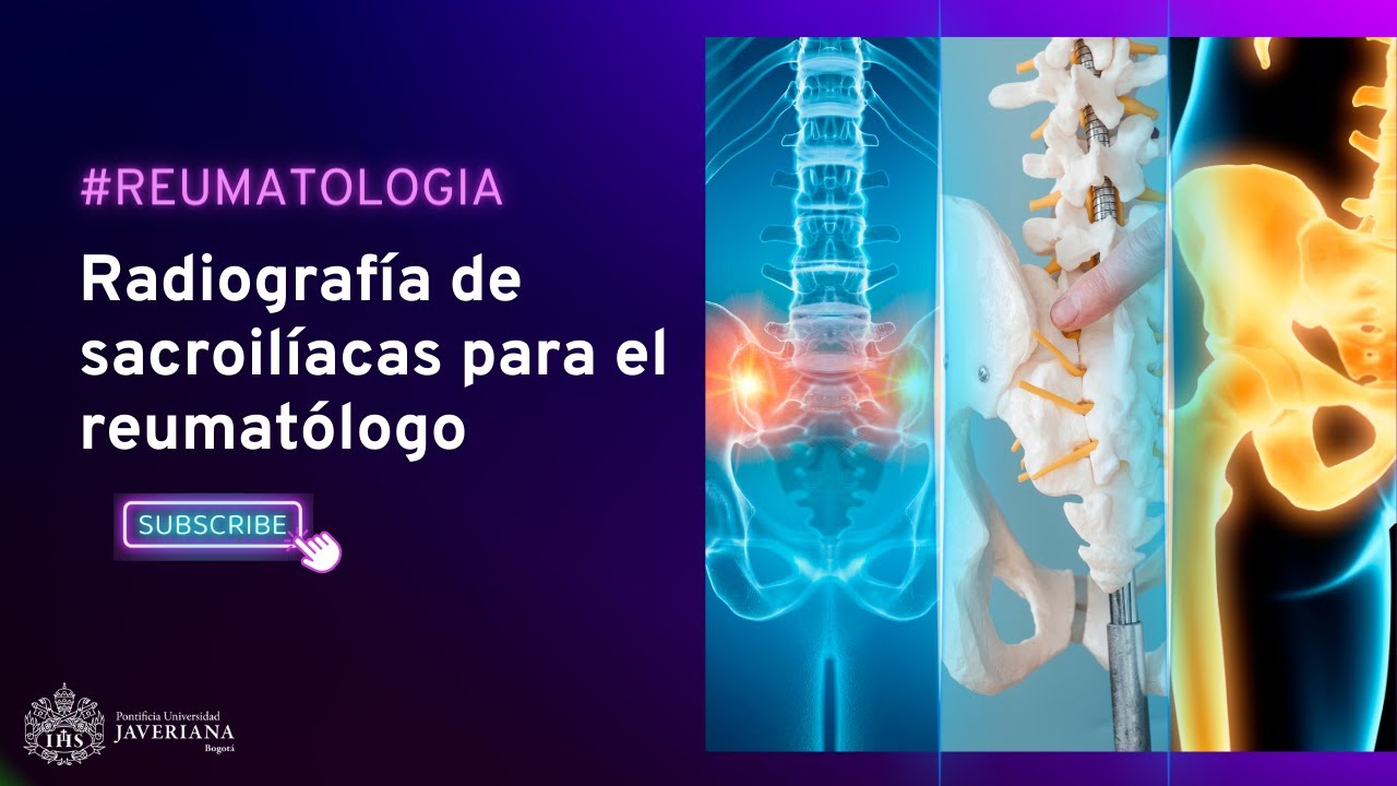 Radiograf&iacute;a de sacroil&iacute;acas para el reumat&oacute;logo