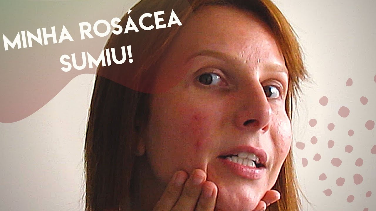 Produtos para ROS&Aacute;CEA durante a AMAMENTA&Ccedil;&Atilde;O e para a VIDA! | Ana1000faces
