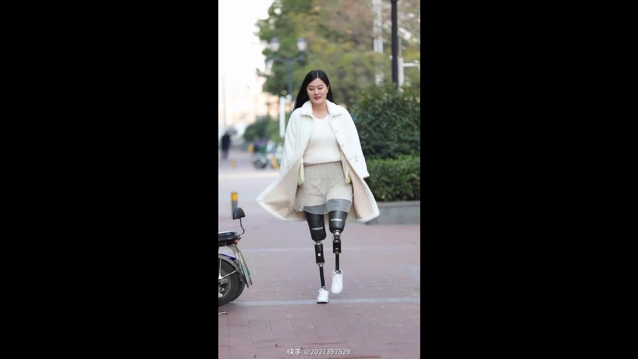 DAK Amputee girl on prosthetics