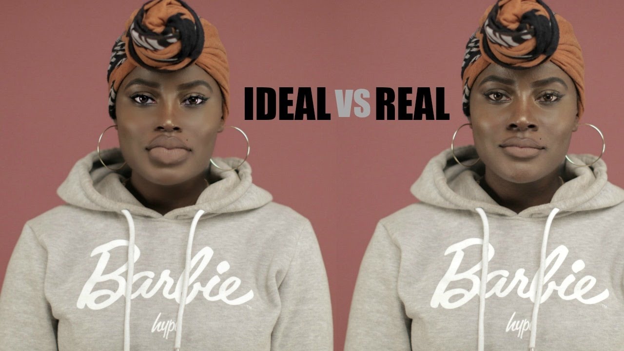 CHASING PERFECTION: INSECURITIES, MY PLASTIC SURGERY & KYLIE JENNER.