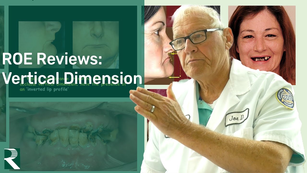 ROE Reviews: Vertical Dimension