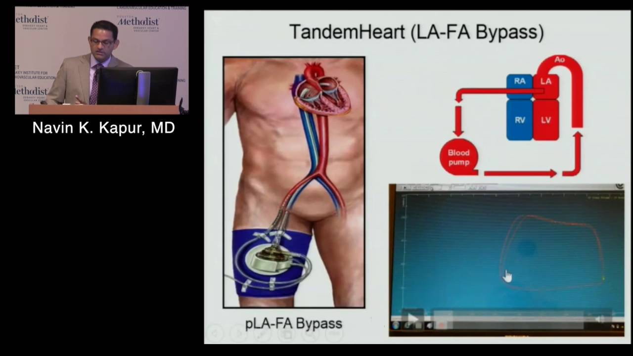 Advances in Acute Mechanical Circulatory Support (Navin K. Kapur, MD) June 16, 2016