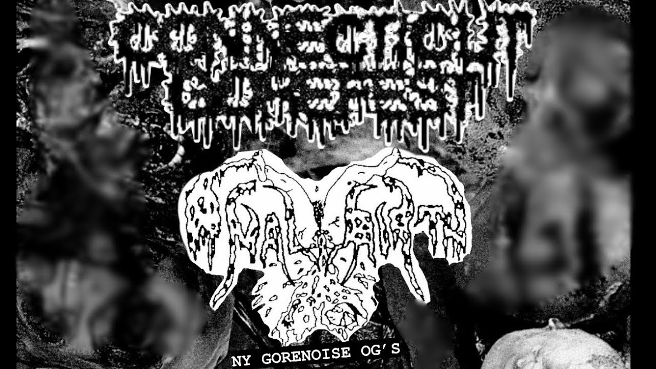 Anal Birth live set CT GOREFEST