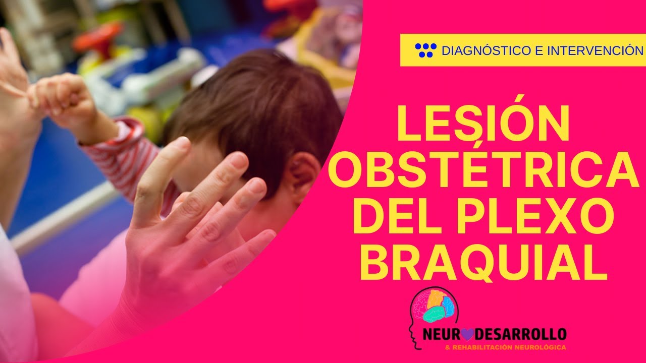 LESIÓN OBSTÉTRICA DEL PLEXO BRAQUIAL - (Que es, Recomendaciones de Rehabilitación Física e integral)