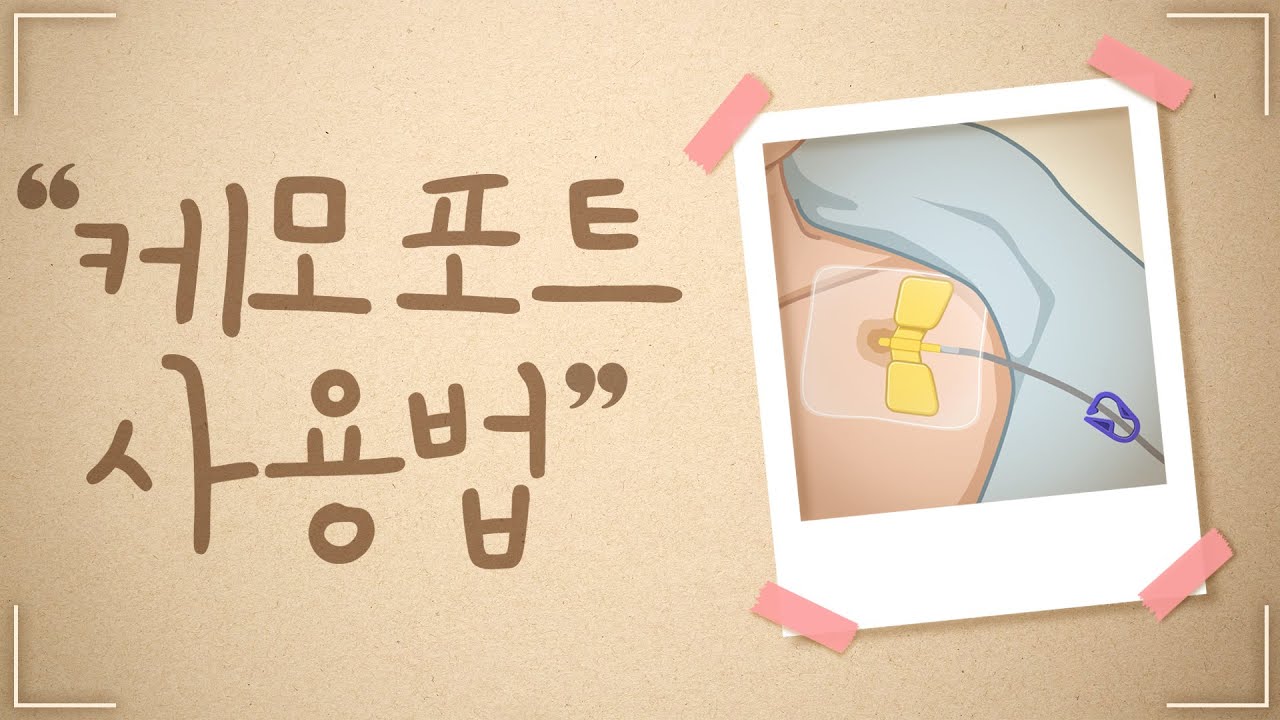 케모포트 사용법