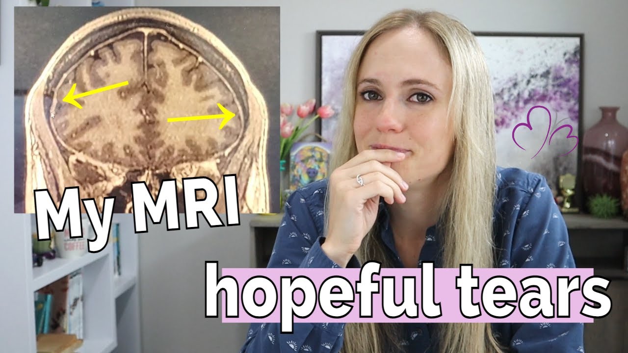 SHOCKING NEWS // My OLD Brain MRI Shows Signs of a Spinal CSF Leak! (with MRI photos & explanation)