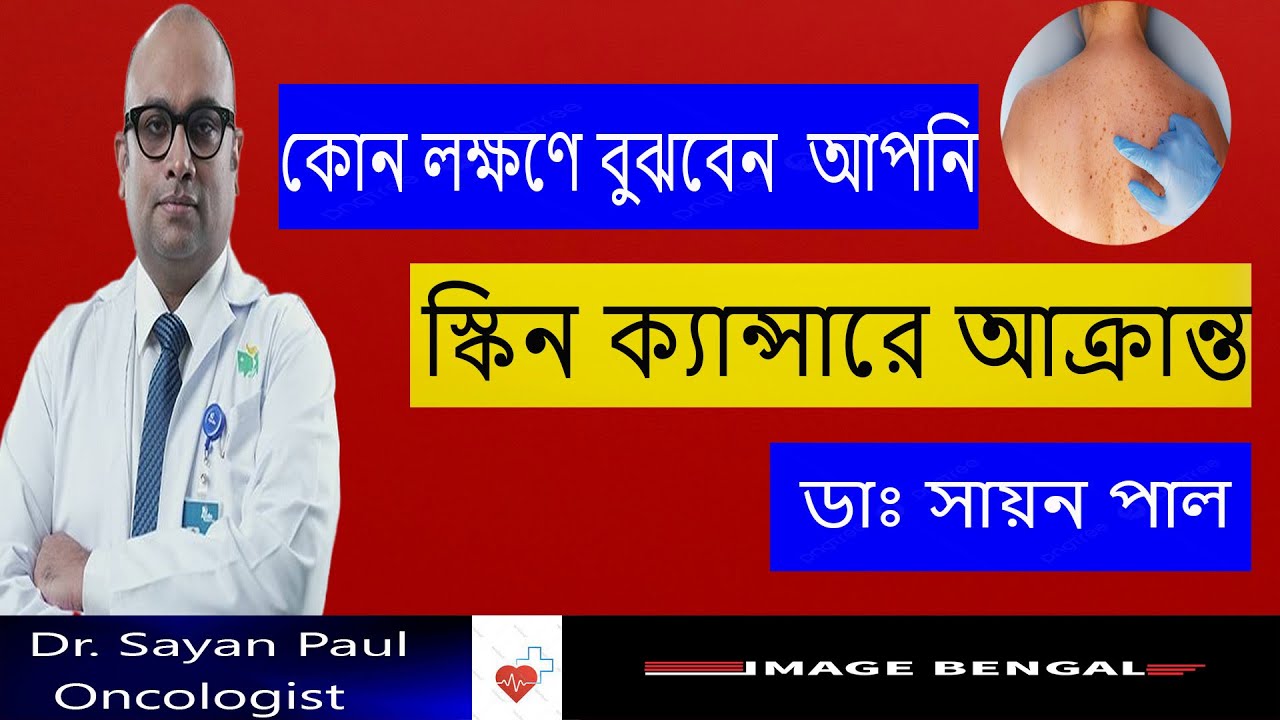 কোন লক্ষণ  দেখলে  বুঝবেন আপনি  SKIN  ক্যান্সারে  আক্রান্ত || ত্বকের ক্যান্সার: কারণ, লক্ষণ,চিকিৎসা