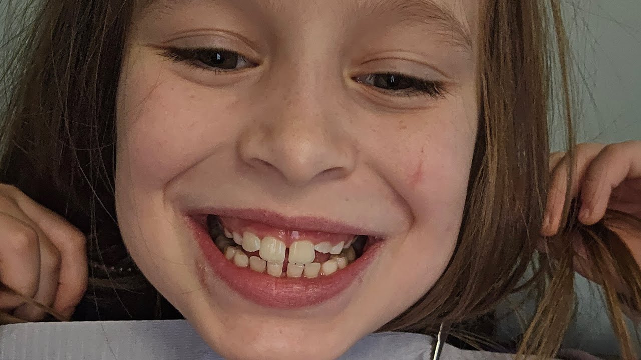 Come with me to the #dentist 
