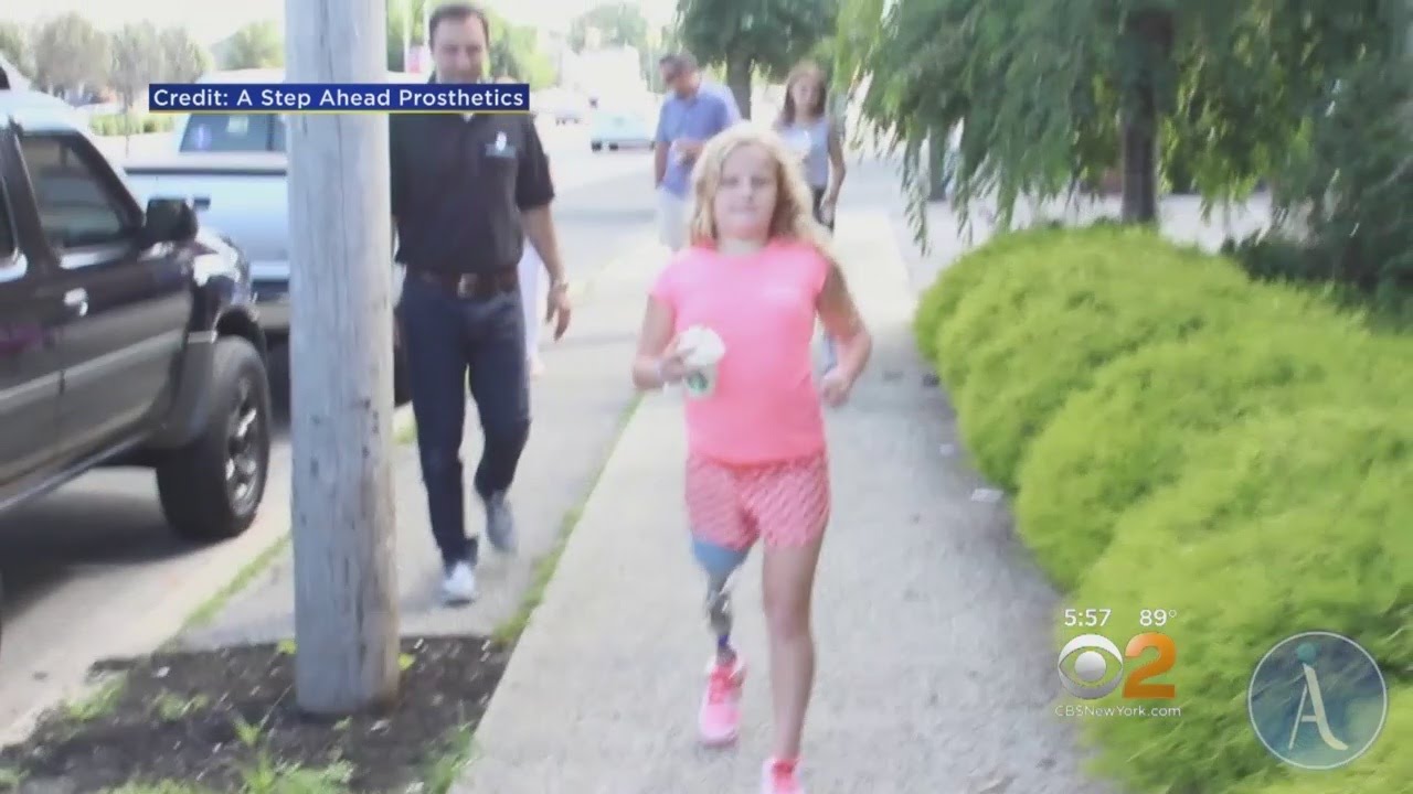 LI Company Provides Prosthetic