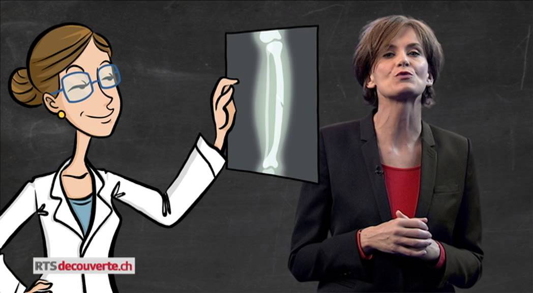 A quoi sert un plâtre ?