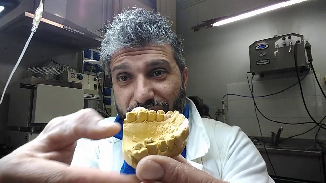 Modellazione in cera. #3 corso di odontotecnica per principianti e studenti. Dental formula.