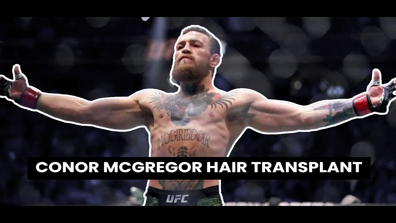Conor Mcgregor Hair Transplant