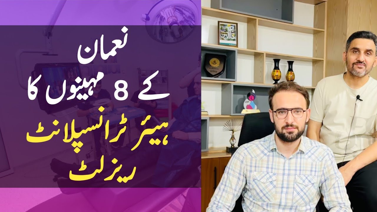 Hair Transplant 8 Months Result | Noman Hair Transplant Experience | Dr. Habib