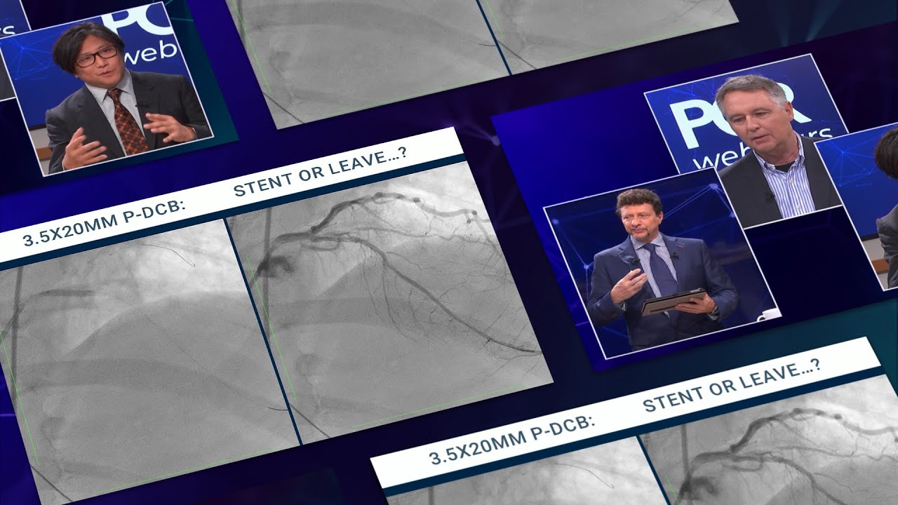 Stent or Leave: considerations for a successful DCB PCI - Webinar