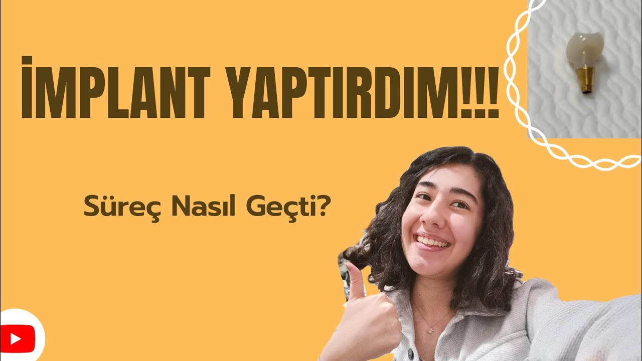 İmplant Yaptırma Süreci Nasıl Geçiyor