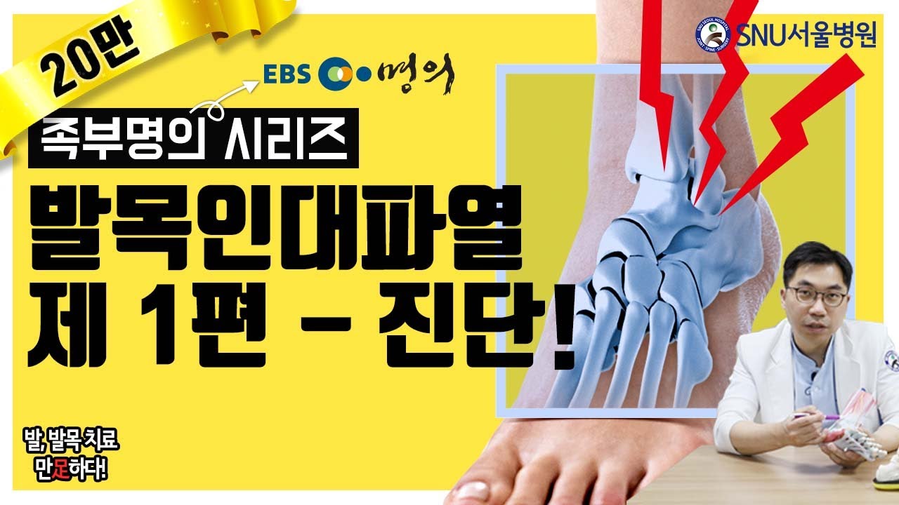 발목인대파열 1편-진단 #인대파열 #부분파열 #발목수술 #발목인대파열수술 #꿀팁 #서상교 #SNU서울병원