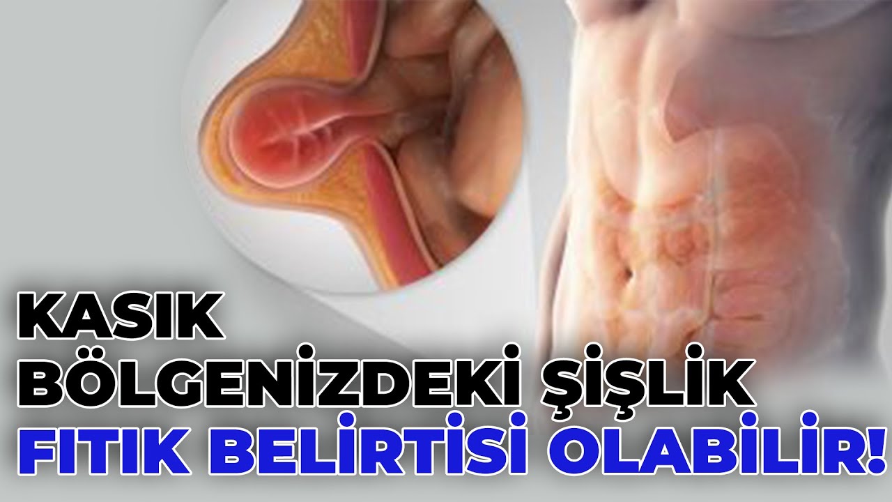 Kasık Fıtığı Nedir? - Op. Dr. Ozan Andaç Erbil