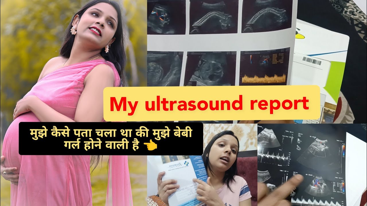 मेरी ultrasound की रिपोर्ट देखिए मुझे कब पता चला था की मेरी Baby Girl आने वाली है 💃#babygirl #baby