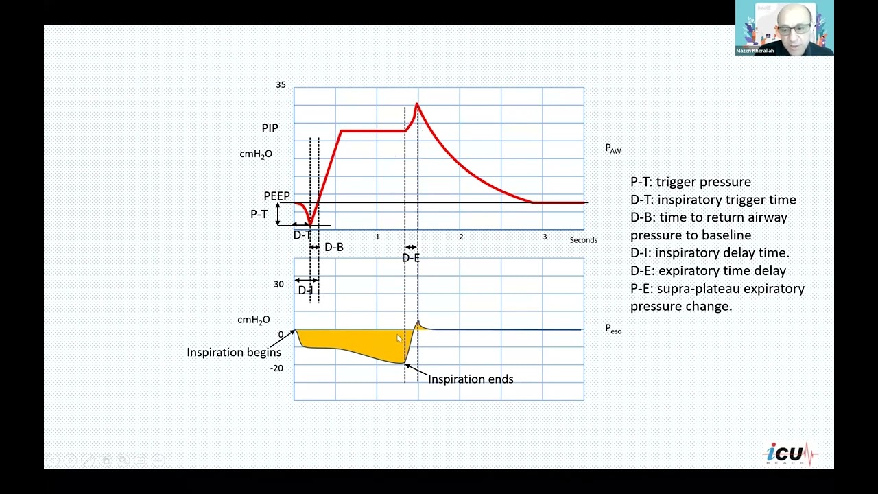 Double triggering and asynchrony on mechanical ventilation