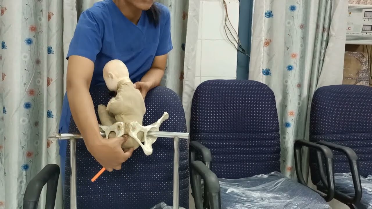 Mechanism of Breech Delivery - By Love Obstetrics And Gynecology