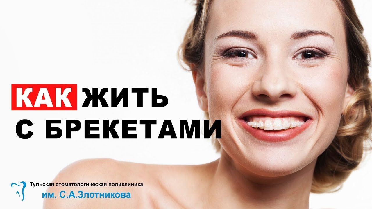 ВСЁ ЧТО НУЖНО ЗНАТЬ О БРЕКЕТАХ | ОТВЕТЫ СТОМАТОЛОГА