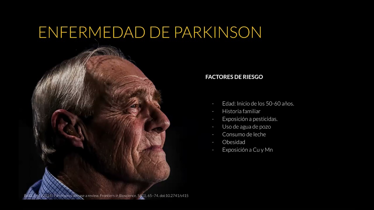 Manifestaciones Oftalmologicas De La Enfermedad De Parkinson Dr. Carlos Perez
