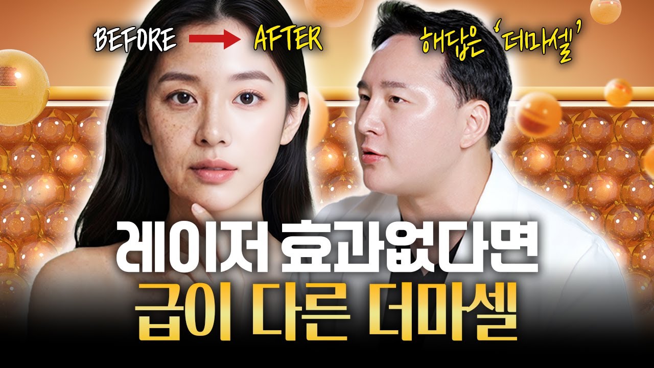 모공 레이저 10번보다 확실한 1번? 피부 재생력의 비밀 '더마셀'