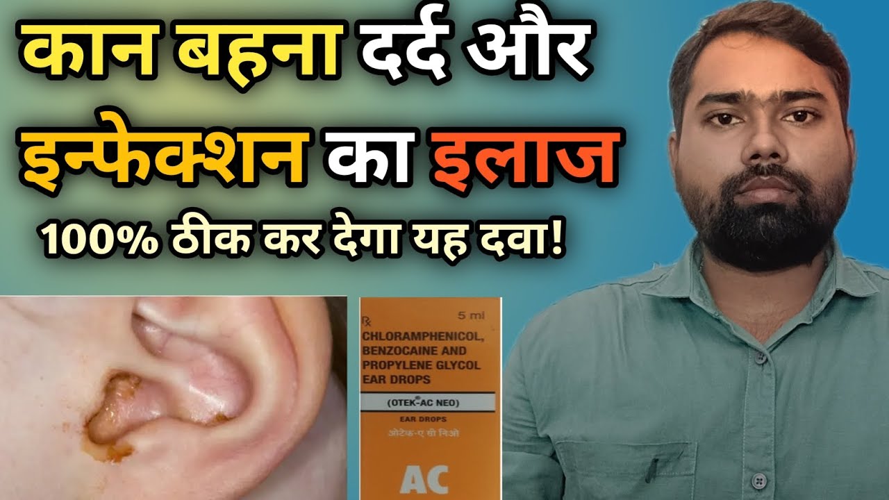  Otek AC Neo Ear Drops Review | Instant Relief from Ear Pain & Infection Explained
