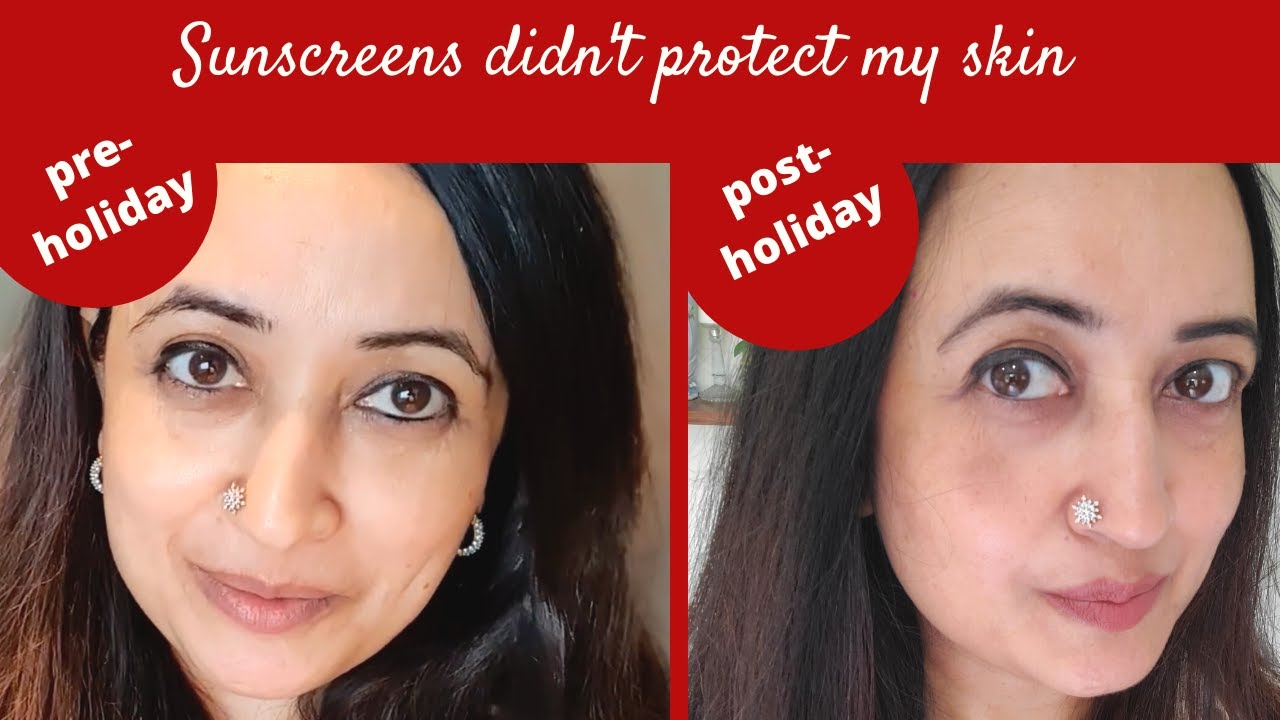 Best Certified Sunscreen DID NOT Prevent Sun Damage, Leading to Hyperpigmentation, Aging, Tanning