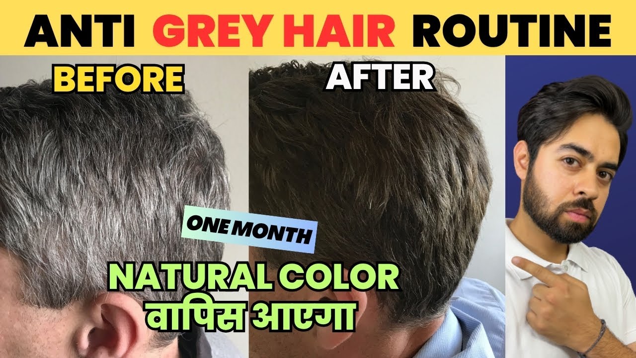 Baal Safed Ho Rahe Hai Jaldi? Ye Karna Shuru Karo | Grey Hair Reversal Possible?