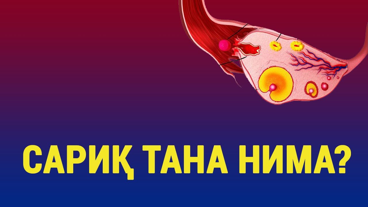 Сариқ тана нима?