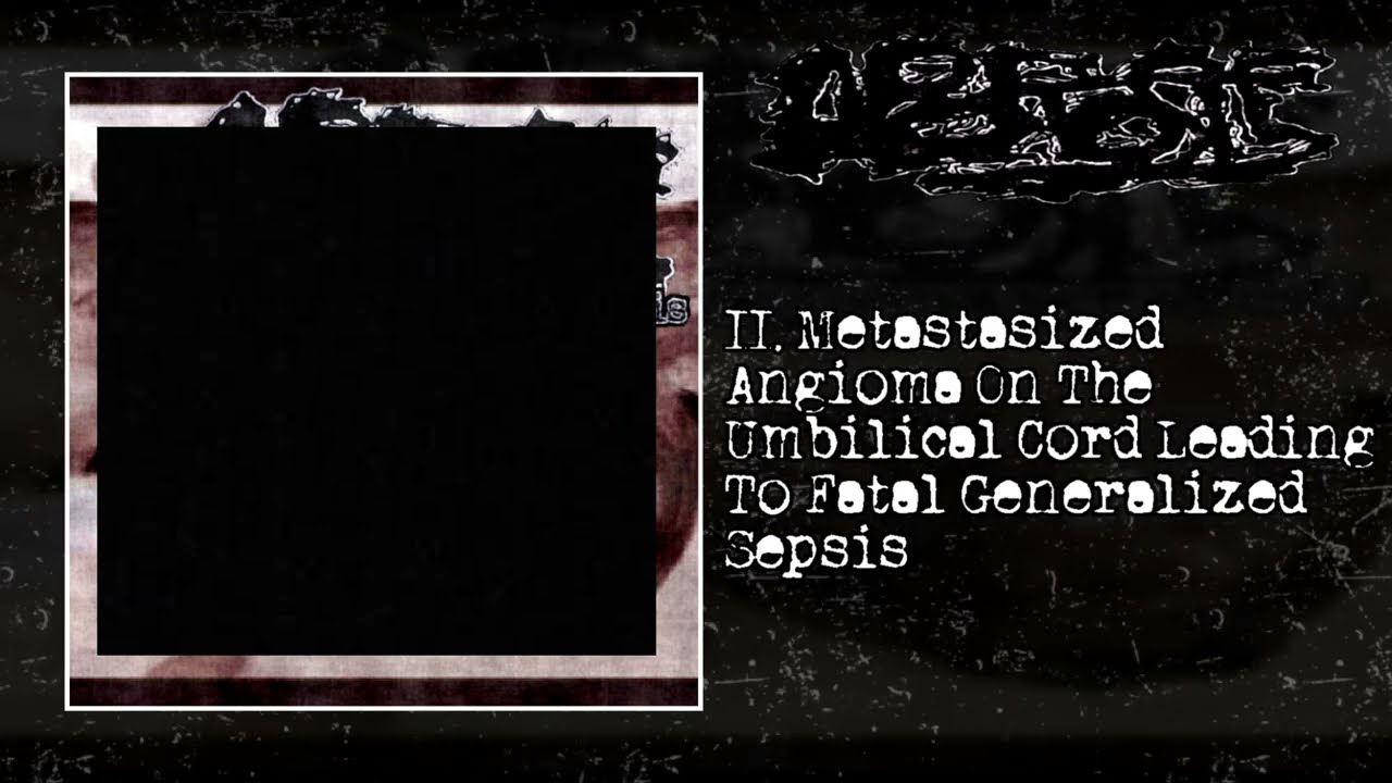 Unparalleled Embryogenesis | FULL EP (Pathological Goregrind)