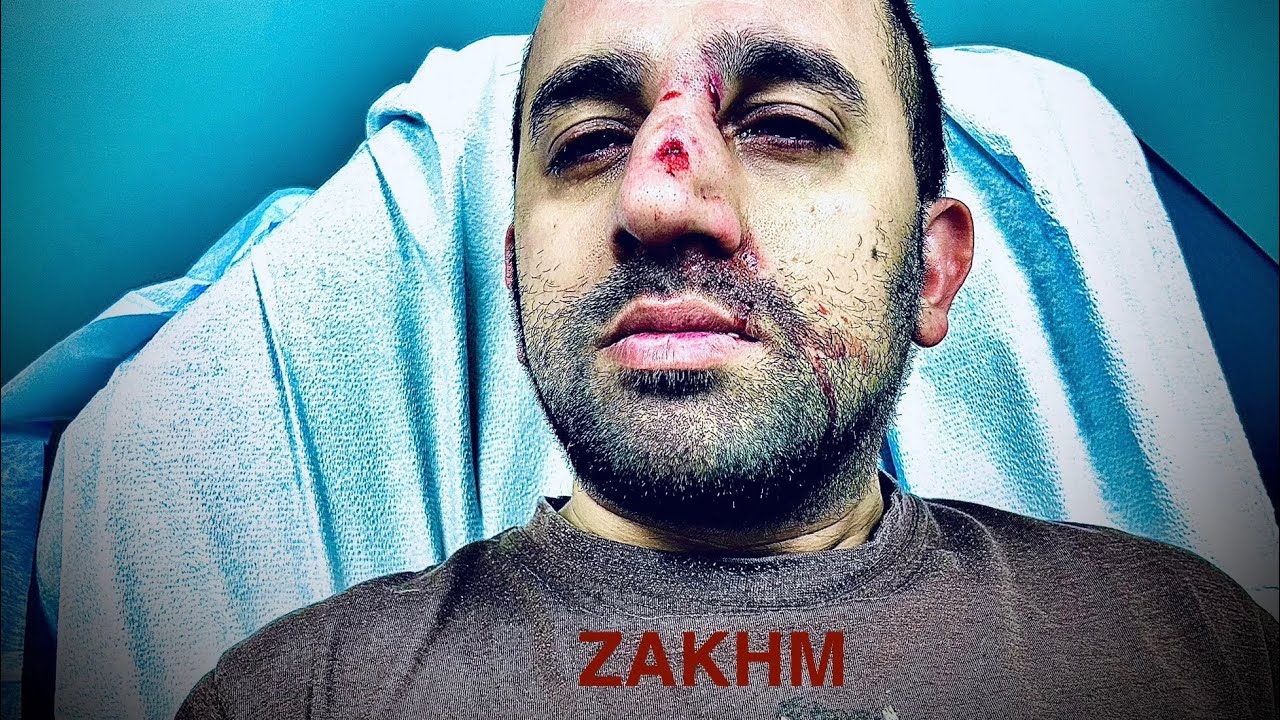 Zakhm (Hindi impromptu monologue - acting scene)