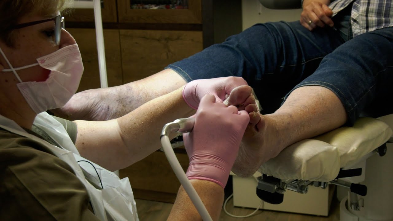20220623 Haaksbergen Pedicure Jose Mentink