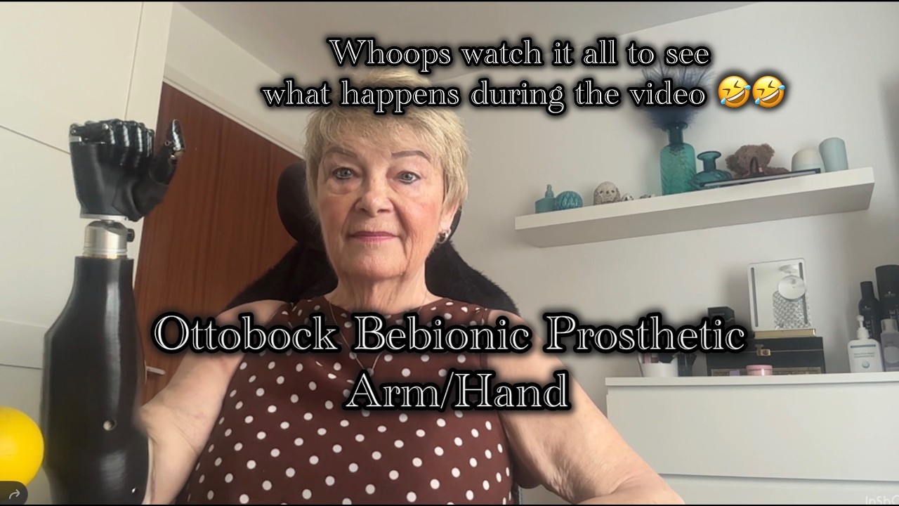 Ottobock Bebionic Prosthetic Arm/Hand
